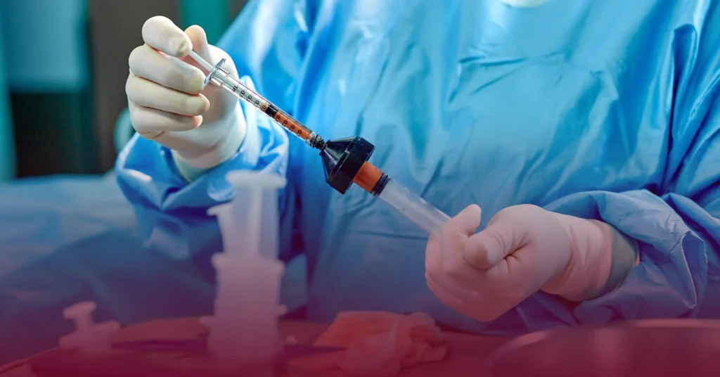 Penile Fat Grafting (Penile Augmentation with Fat Injections) 1 Penile Fat Grafting